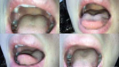 【お医者さんごっこ】いろいろなカメラで身体検査動画（口・唇・舌・鼻の穴・鼻毛：iPhone） 同人動画