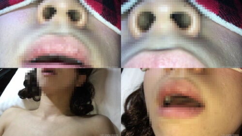 【お医者さんごっこ】いろいろなカメラで身体検査動画（口・唇・舌・鼻の穴・鼻毛：iPhone） 同人動画