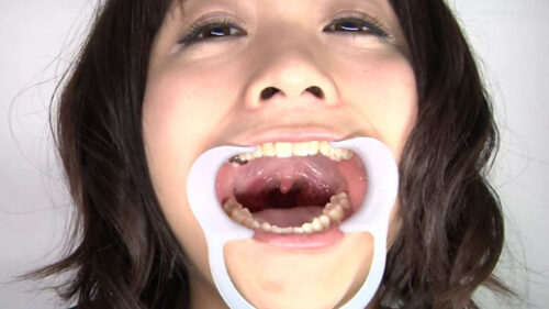 口内銀歯のどちんこ観察 いくちゃん 同人動画