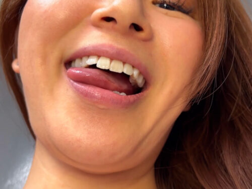 街角で声をかけて口内観察させてもらう　商社営業　れなちゃん 同人動画