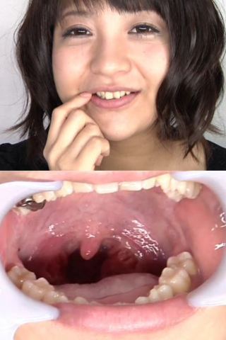 口内銀歯のどちんこ観察 いくちゃん 同人動画