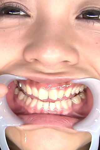 口内銀歯のどちんこ観察 いくちゃん 同人動画