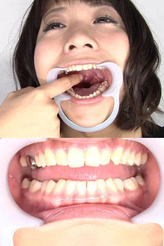 口内銀歯のどちんこ観察 いくちゃん 同人動画