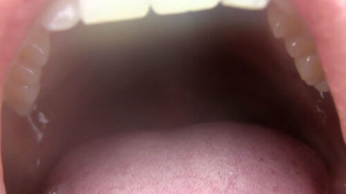 激臭！迫力の口臭嗅がせ 同人動画