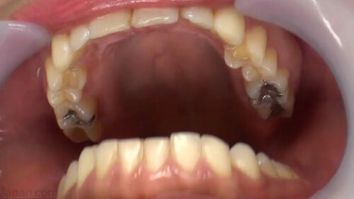 歯口内観察＆咀嚼　高瀬杏 同人動画