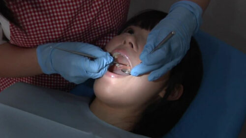 歯フェチ銀歯いっぱい処置室 つぐみちゃん 同人動画