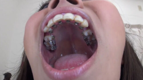 泉水ちゃんの歯・口内自撮り 矯正歯 同人動画