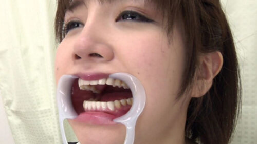 歯フェチ　開口器をつけて歯観察 同人動画