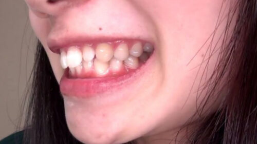歯フェチ！妹系かなこちゃん 歯・口内自撮り 同人動画