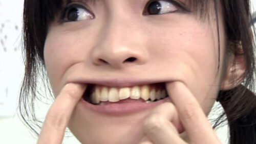 歯フェチ銀歯！処置室 さらちゃん 同人動画