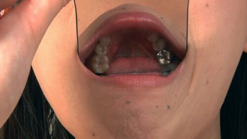 歯フェチ口内観察　まり 同人動画