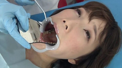 銀歯フェチ処置室 大橋優子 同人動画