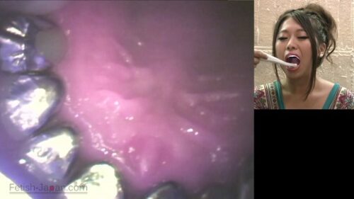 歯フェチびっくり銀歯観察　桜井里緒菜ちゃん 同人動画