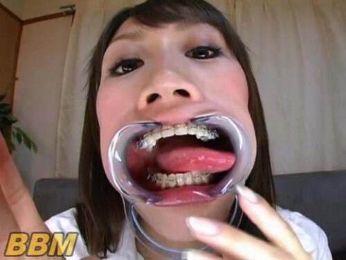 矯正歯口臭フェチプレイ！ 同人動画