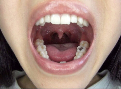 300人のおくち 3