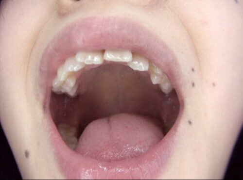 300人のおくち 3