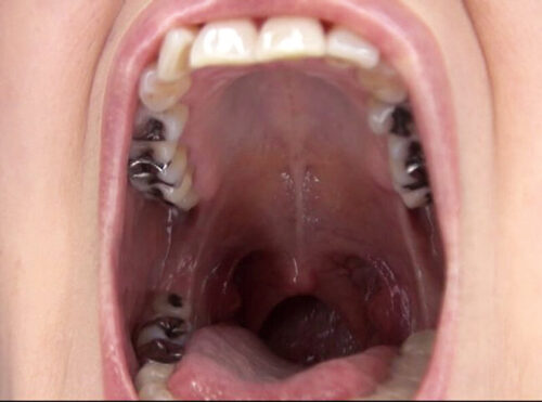 300人のおくち 3