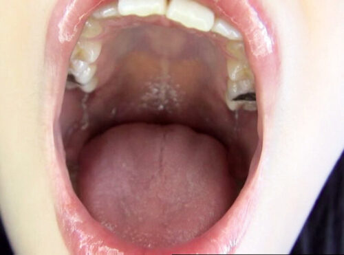 300人のおくち 3