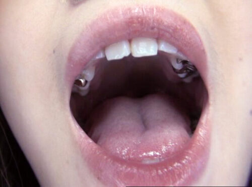 300人のおくち 3