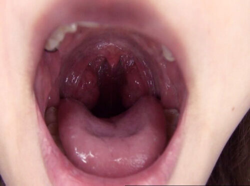 300人のおくち 3