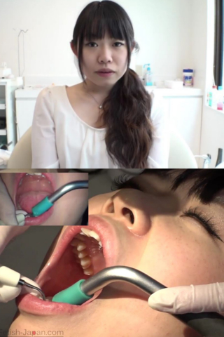 歯フェチ！本物歯科映像　えみ（歯石除去＆口内接写＆前歯検査） 同人動画