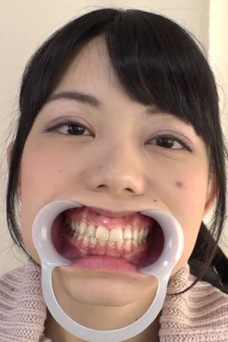 歯フェチ！銀歯観察 桜庭うれあ 同人動画
