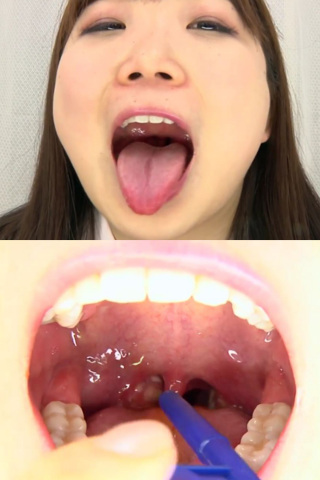 口内フェチのどちんこ観察＆歯スチール撮影メイキング動画２ しおり 同人動画