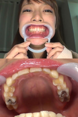 歯口内観察＆咀嚼　高瀬杏 同人動画