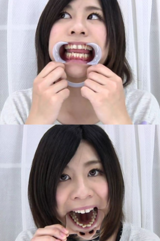 銀歯フェチ！歯観察　早瀬あかり 同人動画