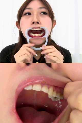 歯フェチ 歯観察 りおん 同人動画