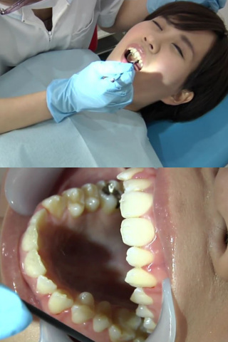 歯フェチ！処置室  伊織ちゃん 同人動画