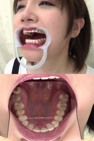 歯フェチ　開口器をつけて歯観察 同人動画