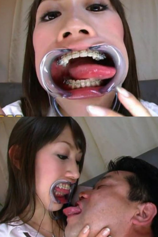 矯正歯口臭フェチプレイ！ 同人動画