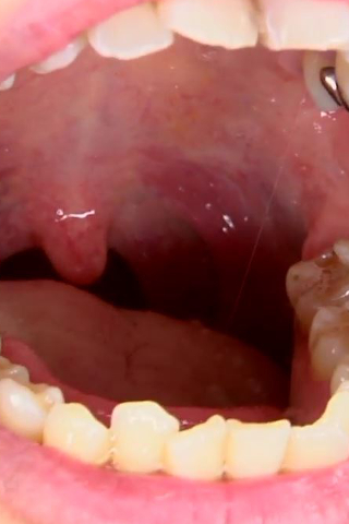 天然娘、早瀬あかりの口内のどちんこ観察 同人動画