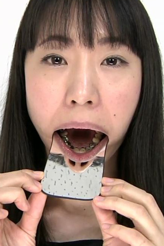 銀歯フェチ銀歯だらけの口内観察 優奈 同人動画