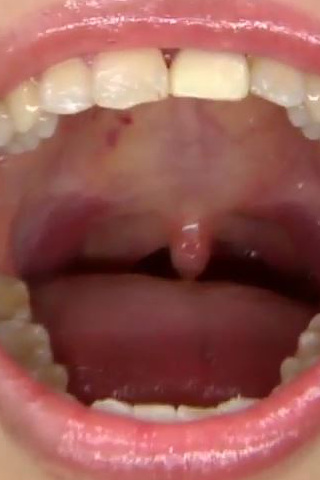 口内フェチのどちんこ観察＆歯スチール撮影メイキング動画 同人動画