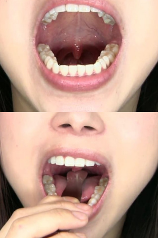 のどちんこ歯フェチ観察 加藤ツバキ 同人動画