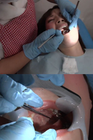 歯フェチ銀歯いっぱい処置室 小春 同人動画