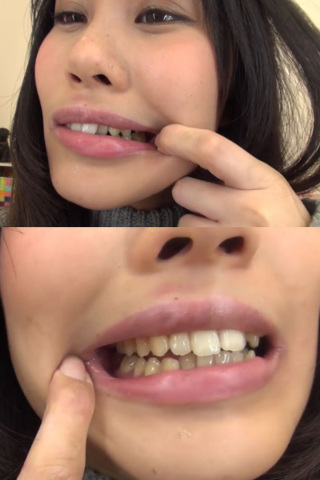 歯フェチ！ 口内自撮り 篠岬ことみちゃん 同人動画