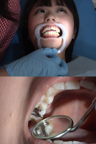 歯フェチ銀歯いっぱい処置室 つぐみちゃん 同人動画