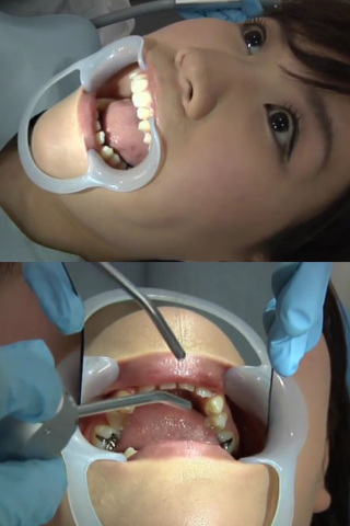歯フェチ！処置室  伊織ちゃん 同人動画