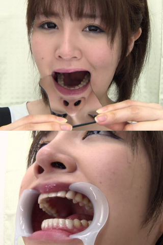 歯フェチ　開口器をつけて歯観察 同人動画
