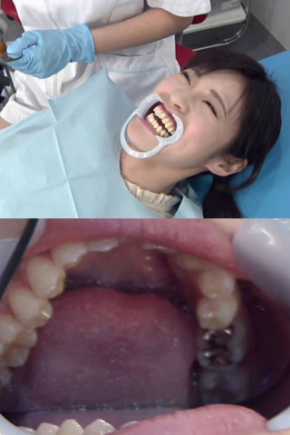 歯フェチ銀歯！処置室 さらちゃん 同人動画