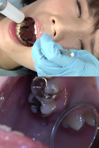 銀歯フェチ処置室 大橋優子 同人動画