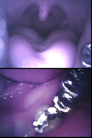 せいかちゃんの口内銀歯観察 同人動画