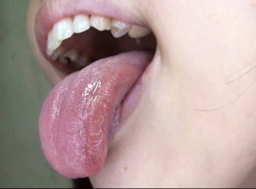 300人のおくち 3