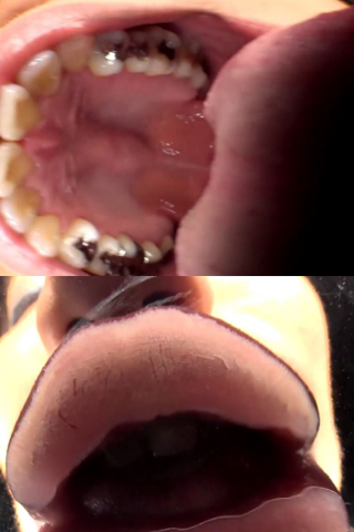 口内ベロフェチ銀歯もチラリ 北村玲奈 同人動画