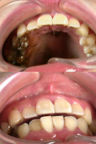 チョコ咀嚼 歯カチカチ 同人動画