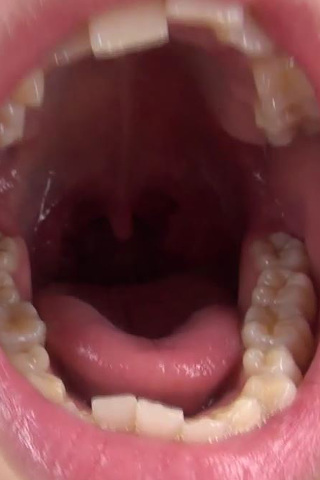 鈴森るなちゃんの歯・口内自撮り 同人動画