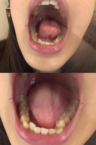 歯フェチ！ 口内自撮り 篠岬ことみちゃん 同人動画